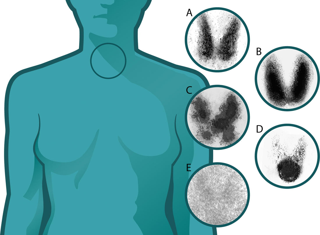 What Thyroid Does and How To Keep It Balanced