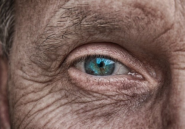 What Causes Dry Eye And How To Take Care Of It